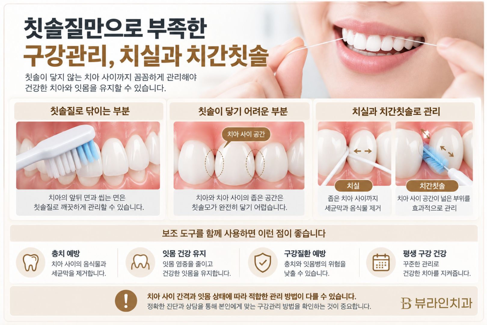 치실과 치간칫솔, 칫솔질만..